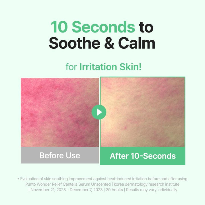 PURITO SEOUL Wonder Releaf Centella Serum Unscented bottle for soothing redness and skin barrier repair. 10 seconds to soothe and calm. For irritation skin!